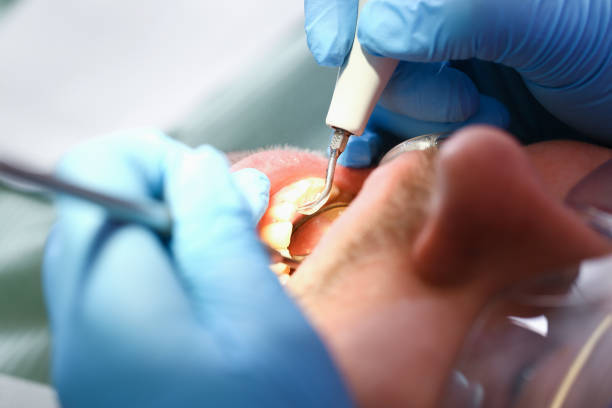 Best Emergency Treatment for Toothache in Shrewsbury, MO
