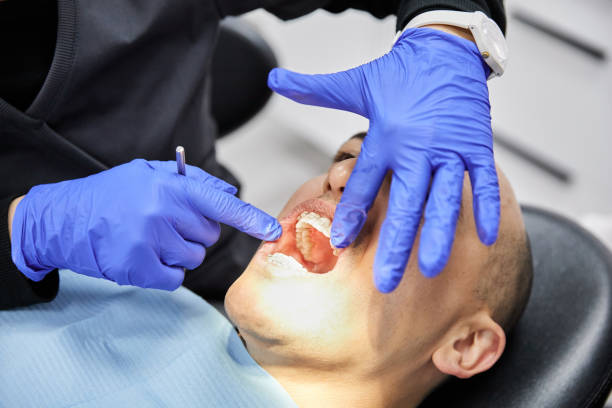 Trusted MO Emergency Dentist Experts