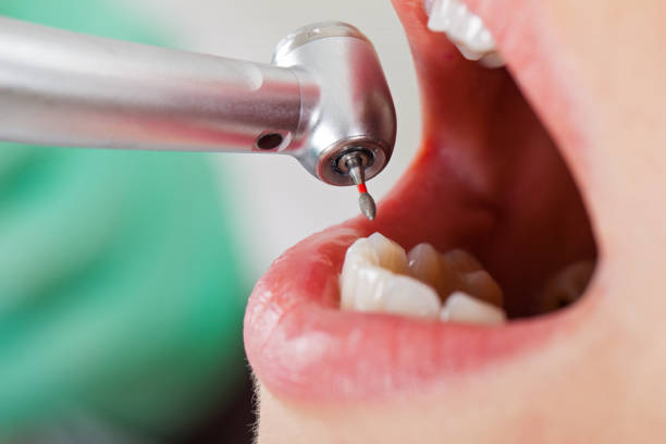 Best Emergency Dental Surgery in Shrewsbury, MO